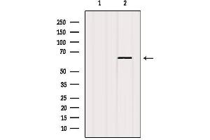 Western blot analysis of extracts from HepG2, using Estrogen Receptor-alpha Antibody. (Estrogen Receptor alpha anticorps  (C-Term))