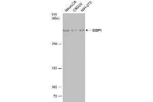 WB Image Various whole cell extracts (30 μg) were separated by 5% SDS-PAGE, and the membrane was blotted with 53BP1 antibody [N1], N-term , diluted at 1:500.