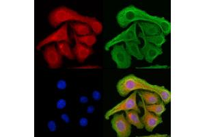ABIN6261826 and ABIN6276867 staining Hela cells by IF/ICC. (FTL anticorps  (C-Term))