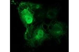 Immunofluorescence (IF) image for anti-Tubulin beta 4a (TUBB4A) antibody (ABIN1501579)
