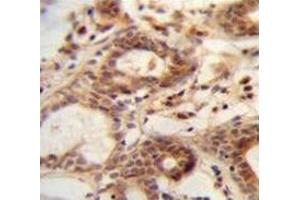 Immunohistochemistry analysis in human breast tissuee (Formalin-fixed, Paraffin-embedded) using NUDT15  Antibody  (C-term), followed by peroxidase conjugation of the secondary antibody and DAB staining.