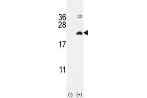 Western blot analysis of IL17F antibody and 293 cell lysate (2 ug/lane) either nontransfected (Lane 1) or transiently transfected with the IL17F gene (2). (IL17F anticorps  (AA 16-45))