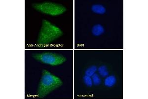 ABIN185266 Immunofluorescence analysis of paraformaldehyde fixed MCF7 cells, permeabilized with 0.