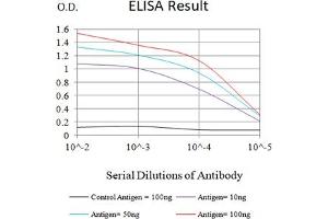 Black line: Control Antigen (100 ng),Purple line: Antigen (10 ng), Blue line: Antigen (50 ng), Red line:Antigen (100 ng) (SARS-Cov2-NP1 (AA 1-180) anticorps)