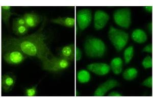 Immunofluorescence microscopy anti -THRB1 (Thyroid hormone receptor Beta 1) antibody  Tissue: Mouse Dendritic cells Primary antibody: Anti THRB1 1:100 1 hr PBS 3% BSA (left) Normal rabbit IgG isotype control (right) Secondary Ab: 488 dye conjugate 1:1000 1 hr Mounting: Fluoromount-G (Southern Biotechnology Associates, Birmingham, AL) for examination. (THRB anticorps  (Isoform 1, N-Term))