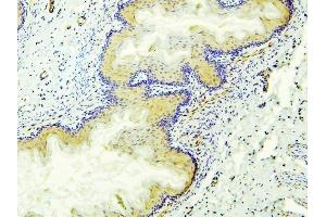 IHC analysis of ALDH1A1 using anti-ALDH1A1 antibody (ABIN7602127). (ALDH1A1 anticorps  (AA 6-342))