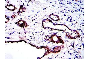 Immunohistochemical analysis of paraffin-embedded prostate tissues using PRK2 mouse mAb with DAB staining.