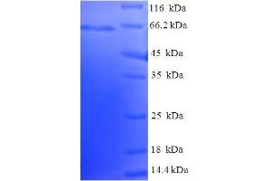 SDS-PAGE (SDS) image for Echinoderm Microtubule Associated Protein Like 2 (EML2) (AA 1-418), (partial) protein (His-SUMO Tag) (ABIN5709469)