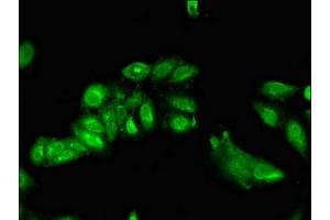 Immunofluorescent analysis of Hela cells using ABIN7143158 at dilution of 1:100 and Alexa Fluor 488-congugated AffiniPure Goat Anti-Rabbit IgG(H+L)