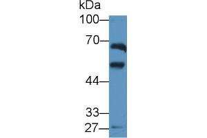 Detection of ALDH1A2 in Rat Testis lysate using Polyclonal Antibody to Aldehyde Dehydrogenase 1 Family, Member A2 (ALDH1A2)