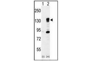 Western blot analysis of ITGA5 (arrow) using CD49e / ITGA5 Antibody (Center) Cat. (ITGA5 anticorps  (Middle Region))