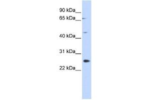 SPATA22 antibody used at 1 ug/ml to detect target protein. (SPATA22 anticorps  (N-Term))