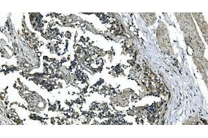 IHC analysis of CDC123 using anti-CDC123 antibody (ABIN7599284). (CDC123 anticorps  (AA 1-336))
