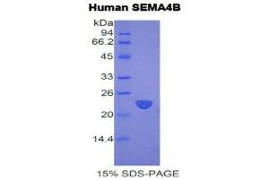 SDS-PAGE (SDS) image for Sema Domain, Immunoglobulin Domain (Ig), Transmembrane Domain (TM) and Short Cytoplasmic Domain, (Semaphorin) 4B (SEMA4B) (AA 192-367) protein (His tag) (ABIN1877886)