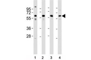 Western blot testing of Pyruvate Kinase antibody at 1:2000 dilution.
