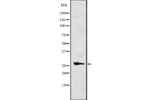 Western blot analysis of Cytochrome b561 using RAW264. (CYB561 anticorps  (Internal Region))