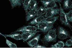 Immunofluorescence staining of HeLa cells (Human cervical epitheloid carcinoma, ATCC CCL-2.