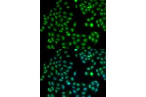 Immunofluorescence analysis of HeLa cells using MKI67 antibody (ABIN5971120). (Ki-67 anticorps)