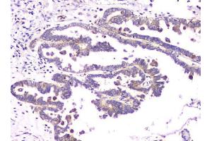 IHC analysis of RAB11B using anti-RAB11B antibody (ABIN6719364). (RAB11B anticorps)