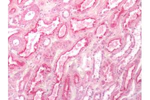 Human Kidney: Formalin-Fixed, Paraffin-Embedded (FFPE)