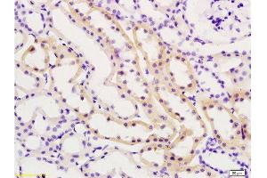 Formalin-fixed and paraffin embedded rat kidney tissue labeled with Anti-TIMP-2 Polyclonal Antibody , Unconjugated at 1:200, followed by conjugation to the secondary antibody and DAB staining