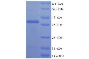SDS-PAGE (SDS) image for Fin Bud Initiation Factor Homolog (FIBIN) (AA 19-211) protein (His-SUMO Tag) (ABIN5711684)