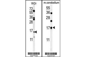 (LEFT)Western blot analysis of TPPP3 Antibody in WiDr cell tissue lysates (35ug/lane).