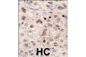 anti-Zinc Finger and BTB Domain Containing 7B (ZBTB7B) (AA 181-210) antibody