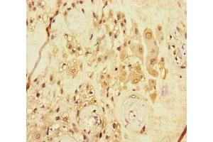 Immunohistochemistry of paraffin-embedded human placenta tissue using ABIN7167986 at dilution of 1:100 (ARHGEF5 anticorps  (AA 433-507))