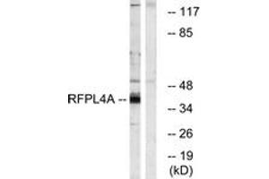 Western blot analysis of extracts from HuvEc cells, using RFPL4A Antibody. (RFPL4A anticorps  (AA 155-204))
