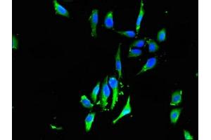 Immunofluorescent analysis of Hela cells using ABIN7153129 at dilution of 1:100 and Alexa Fluor 488-congugated AffiniPure Goat Anti-Rabbit IgG(H+L)