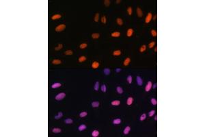 Immunofluorescence analysis of U-2 OS cells using MonoMethyl-Histone H2B-K5 antibody (ABIN7267735) at dilution of 1:100.
