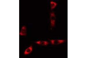 ABIN6277564 staining A549 cells by IF/ICC. (CYB5A anticorps  (Internal Region))