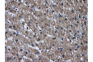 Immunohistochemical staining of paraffin-embedded liver tissue using anti-DCXRmouse monoclonal antibody. (DCXR anticorps)