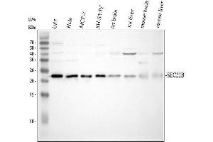 Western blot analysis of SEC22B using anti-SEC22B antibody (ABIN7602121).