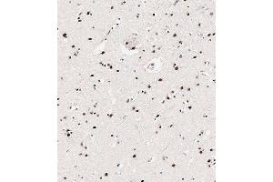 Immunohistochemical analysis of paraffin-embedded Human brain tissue using (ABIN650833 and ABIN2839800) performed on the Leica® BOND RXm.