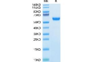Human SPP1 on Tris-Bis PAGE under reduced condition.