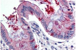 Human Colon (formalin-fixed, paraffin-embedded) stained with LIN7C antibody ABIN462236 followed by biotinylated goat anti-rabbit IgG secondary antibody ABIN481713, alkaline phosphatase-streptavidin and chromogen.