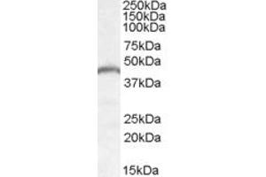 Western Blotting (WB) image for anti-Patatin-Like phospholipase Domain Containing 3 (PNPLA3) (AA 186-197) antibody (ABIN1493896) (PNPLA3 anticorps  (AA 186-197))