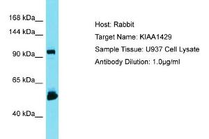Host: Rabbit Target Name: KIAA1429 Sample Type: U937 Whole Cell lysates Antibody Dilution: 1. (VIRMA/KIAA1429 anticorps  (C-Term))
