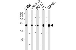 Western blot analysis of lysates from , mouse Neuro-2a, rat PC-12, C6 cell line and mouse brain tissue lysate(from left to right), using UCHL1 Antibody (ABIN1539817 and ABIN2843804). (UCHL1 anticorps)