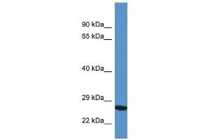 Western Blot showing YIPF4 antibody used at a concentration of 1. (YIPF4 anticorps  (N-Term))