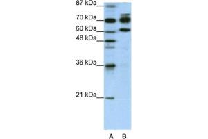 Western Blotting (WB) image for anti-Adenosine Deaminase, RNA-Specific, B1 (ADARB1) antibody (ABIN2462101) (RED1 anticorps)