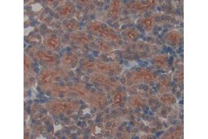 Used in DAB staining on fromalin fixed paraffin- embedded kidney tissue