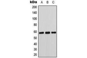 Western blot analysis of Cytochrome P450 11B1/2 expression in K562 (A), Caki1 (B), MCF7 (C) whole cell lysates. (Cytochrome P450 11B1/2 (N-Term) anticorps)