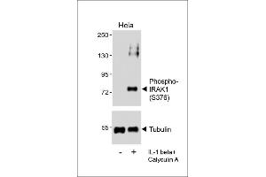 Western blot analysis of lysates from Hela cell line, untreated or treated with IL-1 beta(20 ng/mL) + Calyculin A(100nM), using (ABIN6241064 and ABIN6578961) (upper) or Tubulin (lower).
