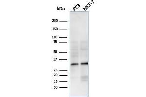 Western Blot Analysis of PC3 and MCF-7 cell lysate using NKX2. (Recombinant NKX2-8 anticorps  (AA 10-123))
