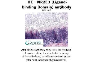 Image no. 1 for anti-Nuclear Receptor Subfamily 2, Group E, Member 3 (NR2E3) antibody (ABIN1737507) (NR2E3 anticorps)