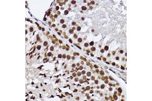 Immunohistochemistry of paraffin-embedded rat testis using GTF2F2 Rabbit mAb (ABIN7267373) at dilution of 1:100 (40x lens).