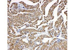 IHC-P: Troponin C antibody testing of rat heart tissue (TNNC1 anticorps  (N-Term))